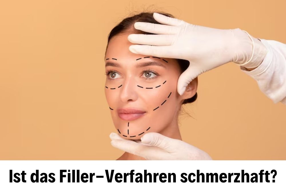 Füllungen Füllungen