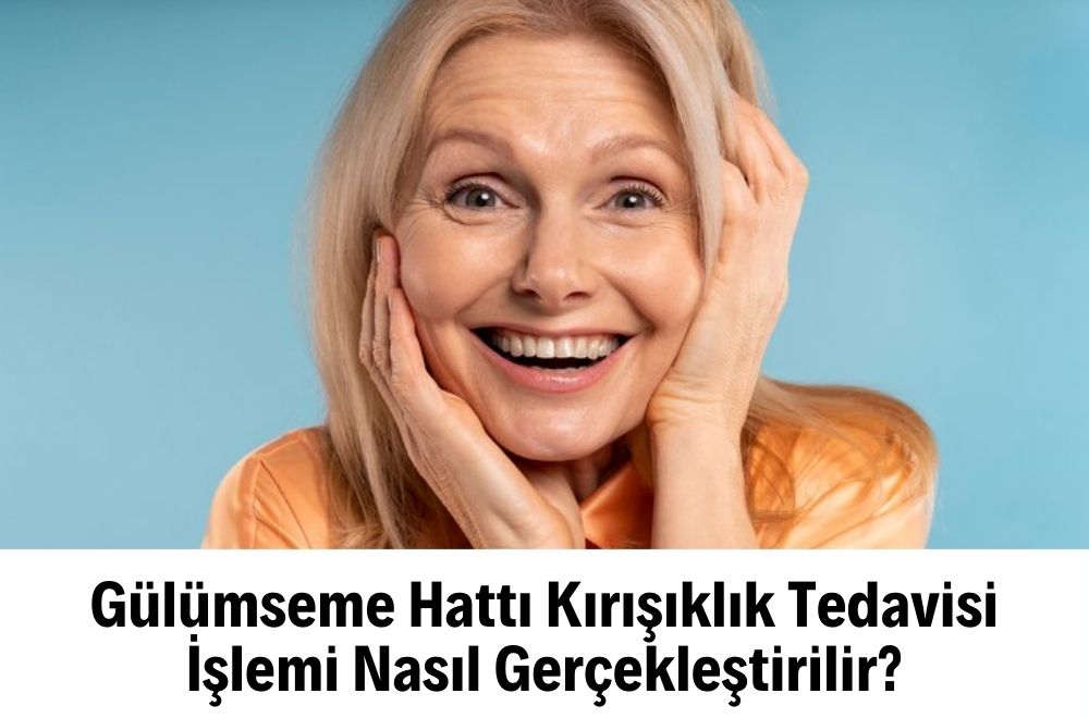 Gülümseme Hattı Kırışıklık Tedavisi Gülümseme Hattı Kırışıklık Tedavisi