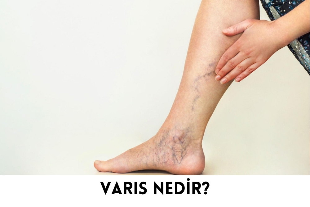 Varis Varis
