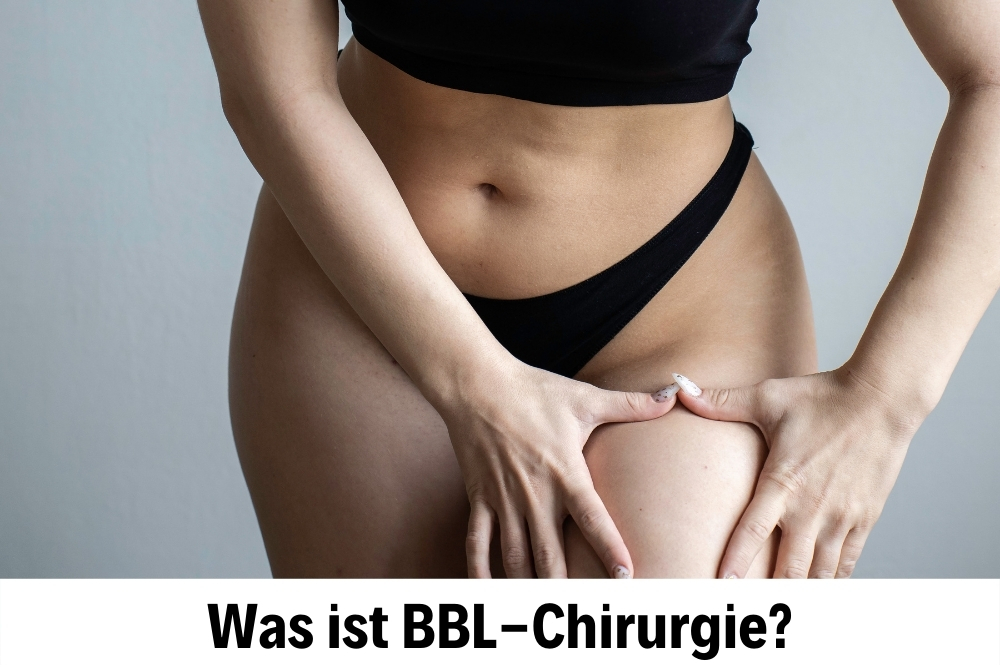 BBL-Chirurgie BBL-Chirurgie