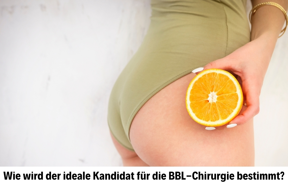 BBL-Chirurgie BBL-Chirurgie