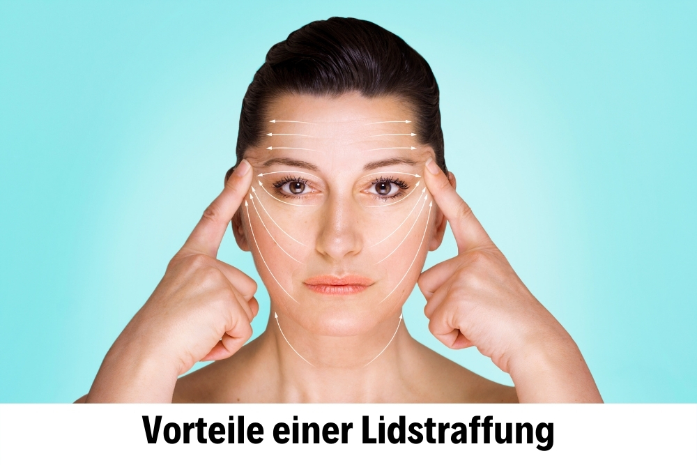 Lidstraffung Lidstraffung