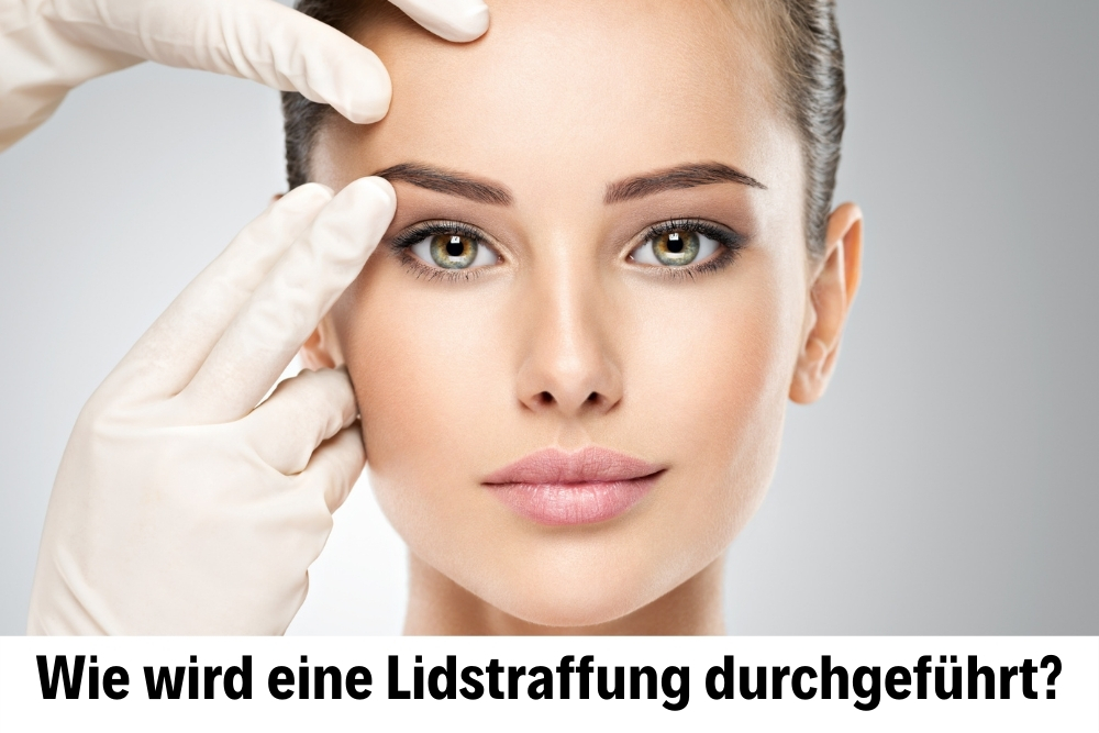 Lidstraffung Lidstraffung