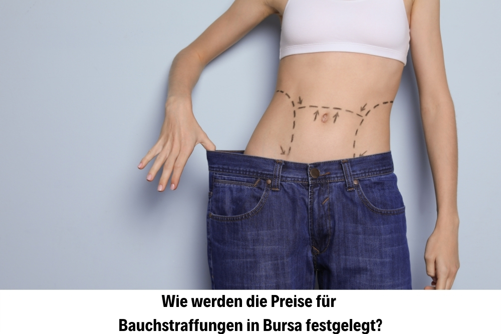 Bauchstraffung Bauchstraffung