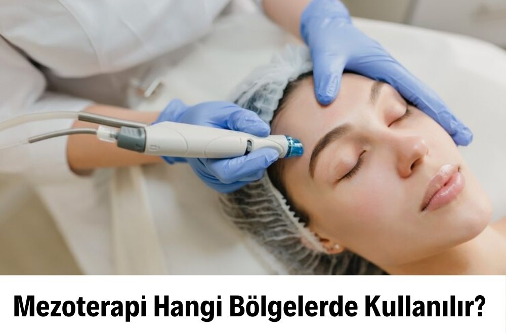 Mezoterapi Mezoterapi