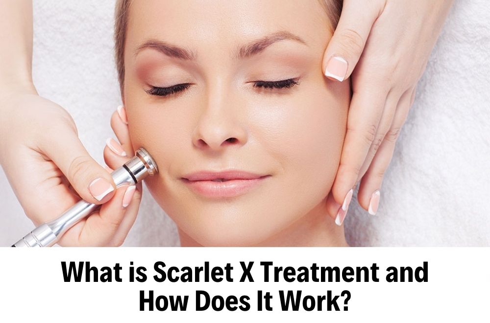Scarlet X